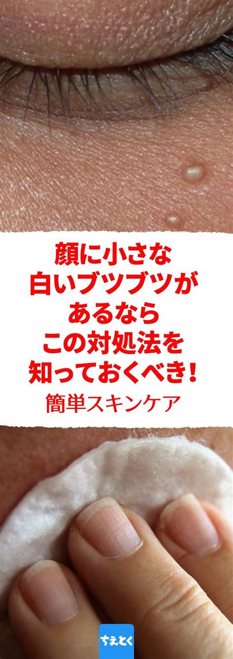 乳首に白いできもの！どうして？治し方は！？ ～乳。